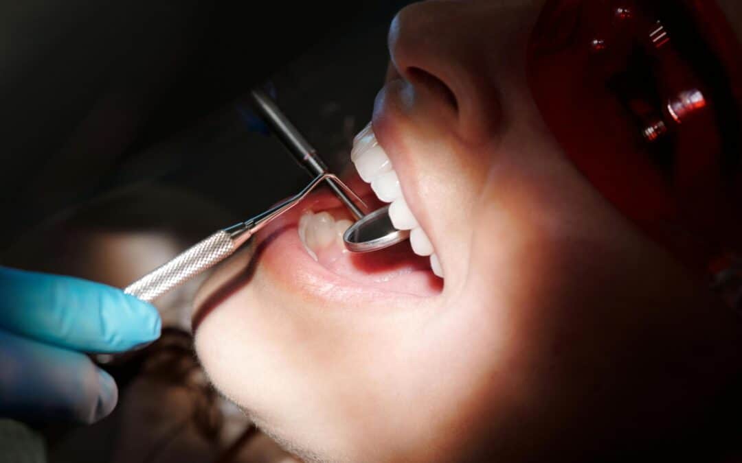 Top-Rated Dentist in Sarasota: Your Smile’s Best Friend