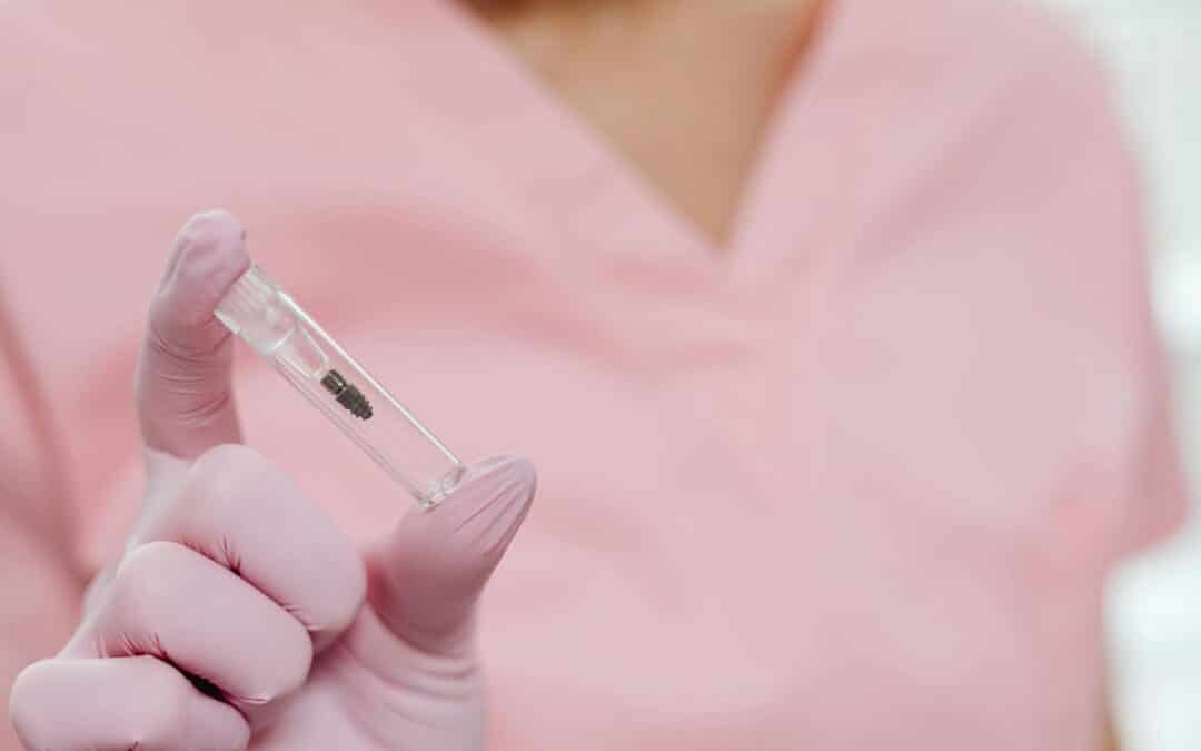 Do Dental Implants Hurt? Understanding Pain Levels and Relief
